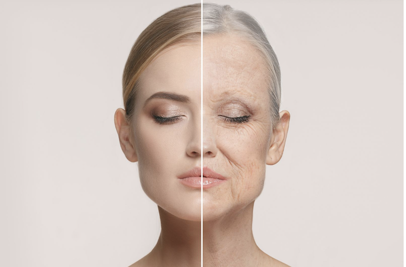 Cheek filler consultation for midface volume concerns in Melbourne