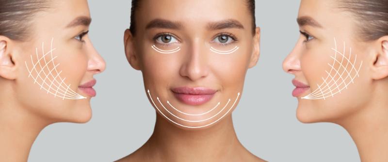 Thread Lift treatment