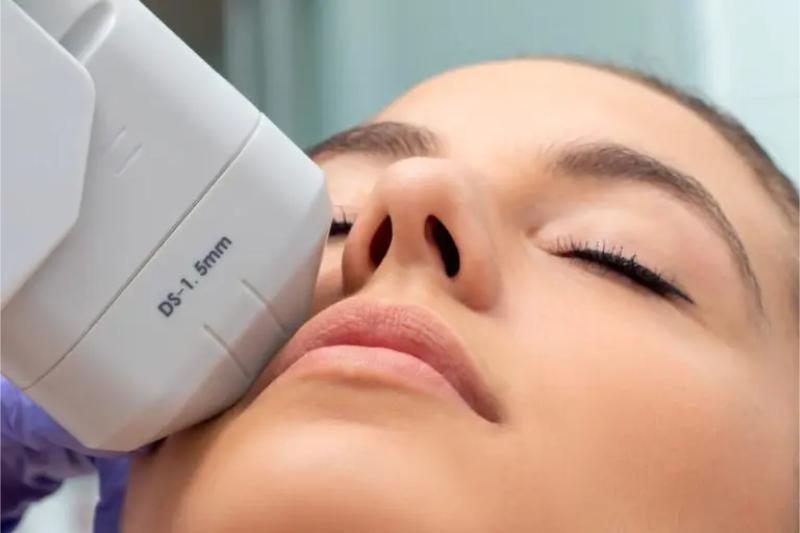 HIFU restores the lost volume of skin