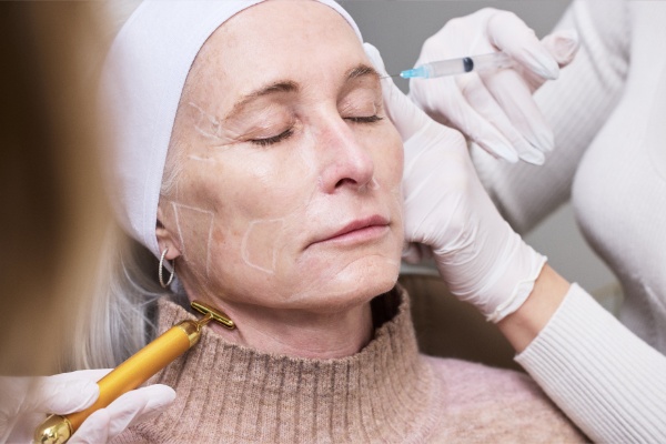 sculptra face