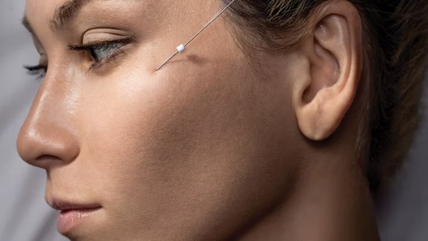 sculptra melbourne