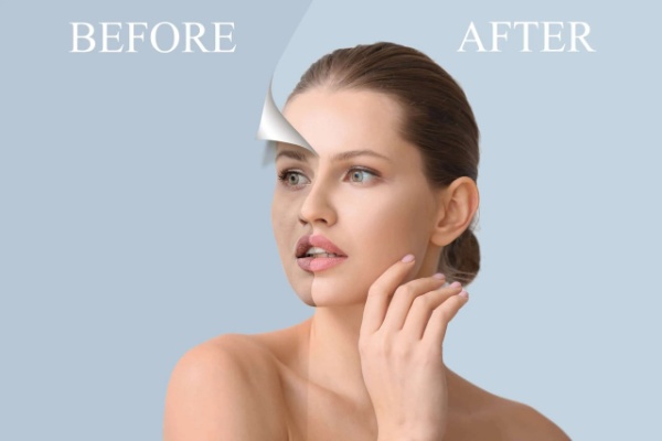 forma treatment