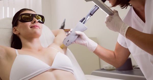 q switch laser underarm