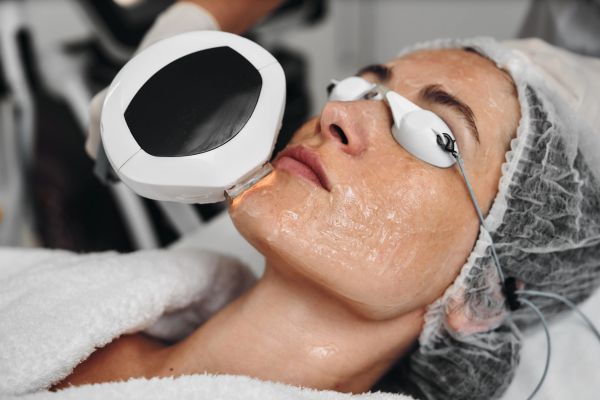 collagen for acne scars