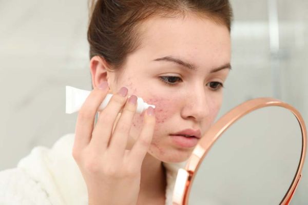 collagen for acne scars