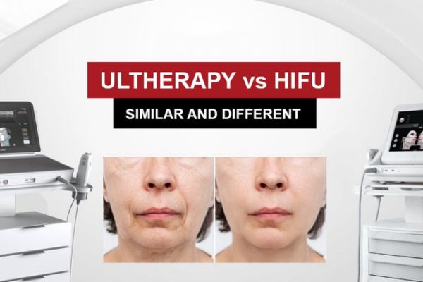 ultherapy prime vs hifu