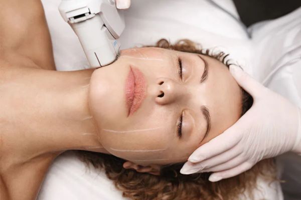 ultherapy prime