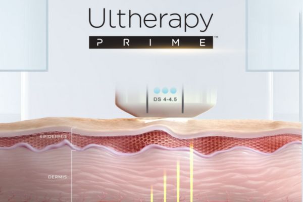 ultherapy prime
