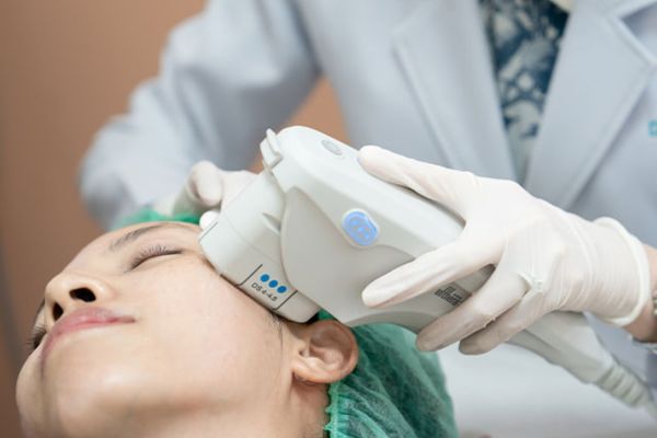 Real Ultherapy process